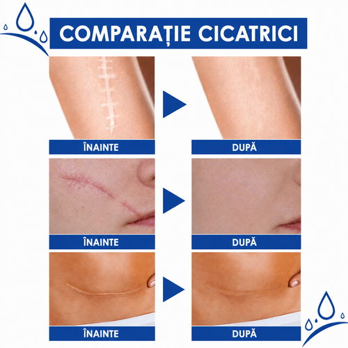 Gel Reparator  Cicatrici