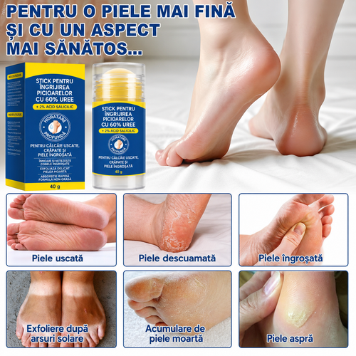 Balsam cu uree pentru mâini și picioare
