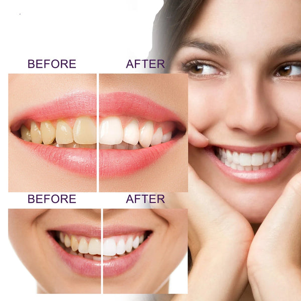 V34-Purple-ToothpasteTeeth-Whitening-Stain-Removal-Anti-Pigmentation-Fights-Yellow-Teeth-Deep-Cleansing-Brightening.jpg
